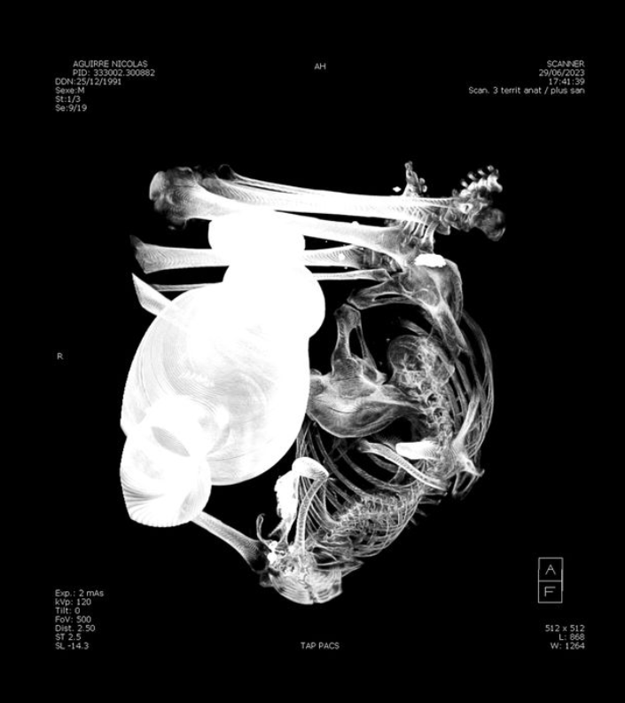 « Le lent demain » à la Galerie Air de Paris : quand le cinéma sensible de Guy Gilles inspire les artistes latino-américains 2 nicolas aguirre